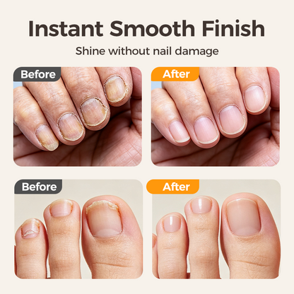 💅 2-in-1 Smart Electric Nail Clipper & Polisher 🌟