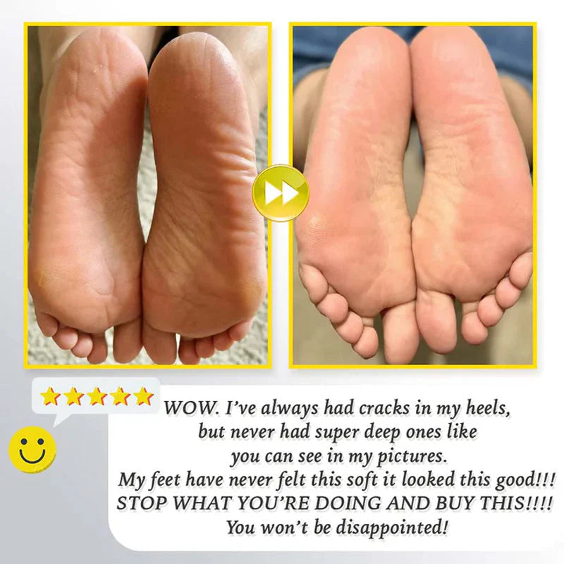 Rechargeable electric foot file for calluses Two speeds and removable grinding head USB charging Available in four colors