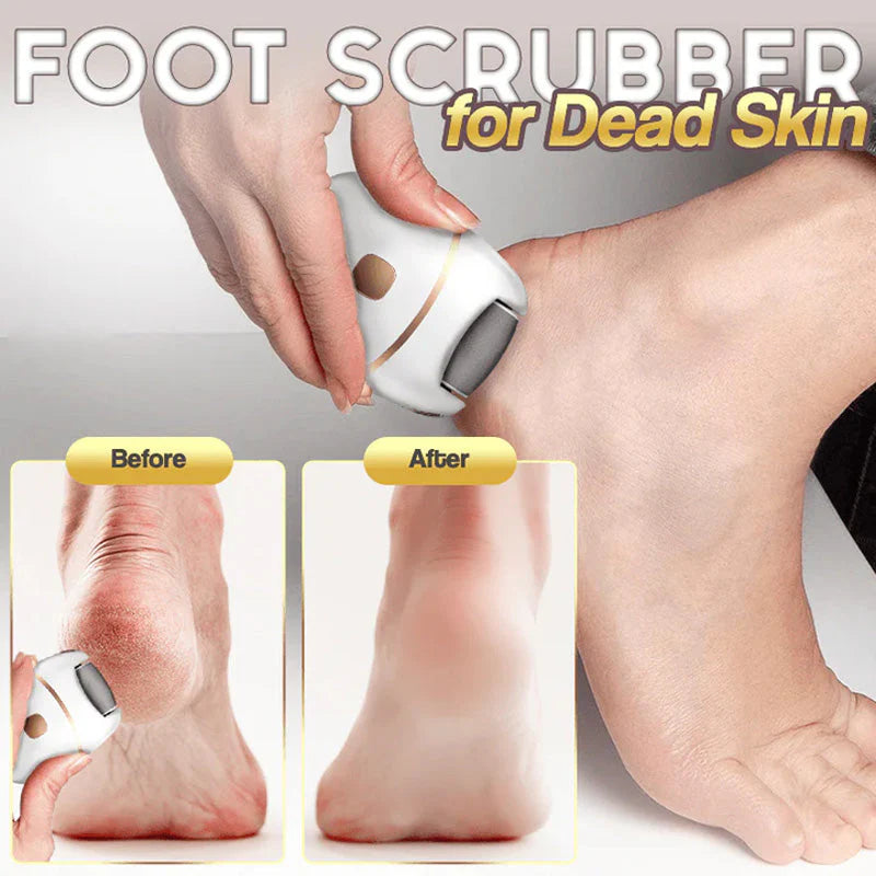 Rechargeable electric foot file for calluses Two speeds and removable grinding head USB charging Available in four colors