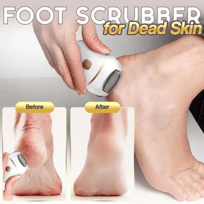 Rechargeable electric foot file for calluses Two speeds and removable grinding head USB charging Available in four colors