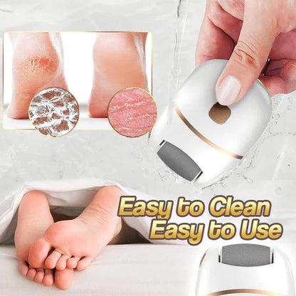 Rechargeable electric foot file for calluses Two speeds and removable grinding head USB charging Available in four colors