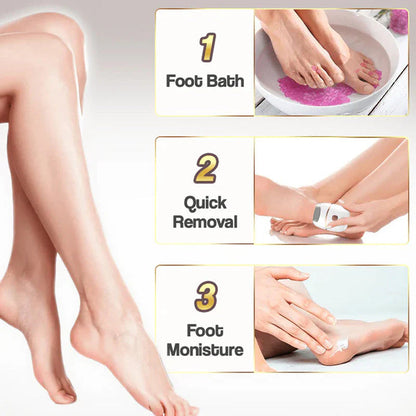 Rechargeable electric foot file for calluses Two speeds and removable grinding head USB charging Available in four colors