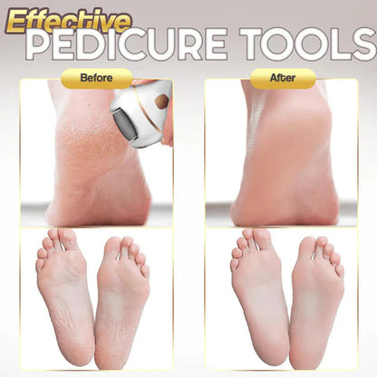Rechargeable electric foot file for calluses Two speeds and removable grinding head USB charging Available in four colors